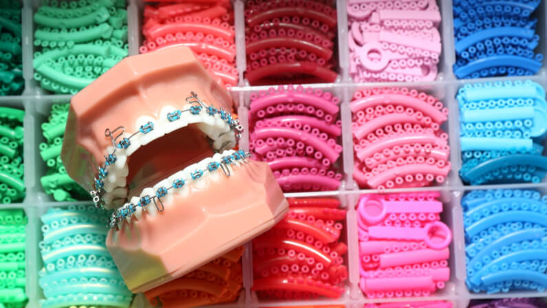 various braces colors