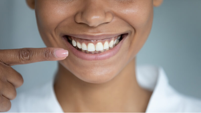 https://www.mybrownstonedental.com/wp-content/uploads/2021/12/woman-with-black-gums.jpg