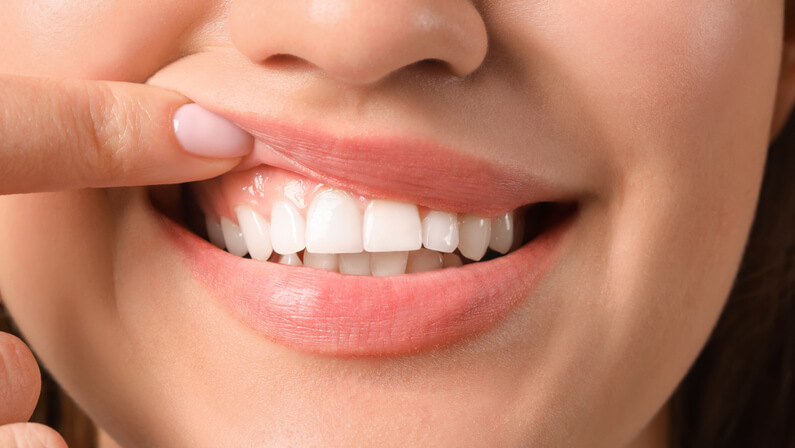 woman with healthy gums