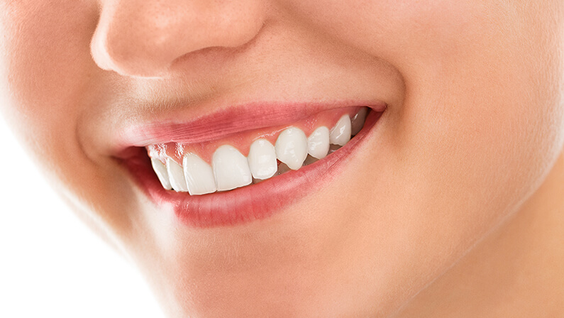How to Get Rid of White Spots on Teeth