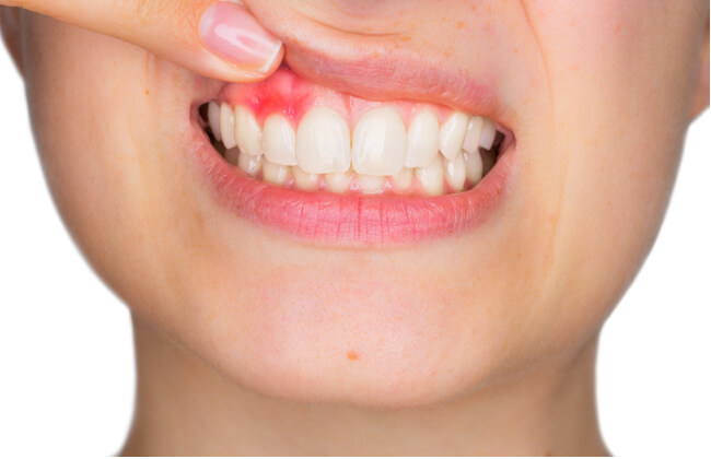 Why Do My Gums Hurt_ Reasons + What to Do About It