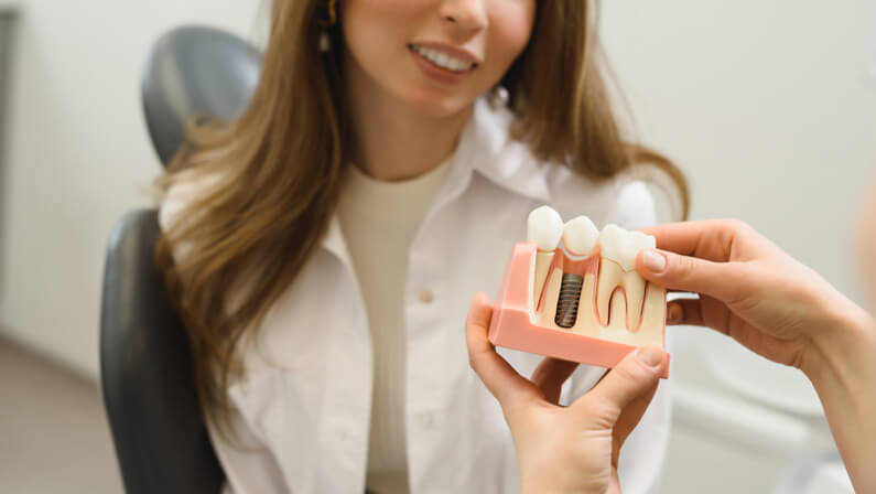 Dental Implants concept