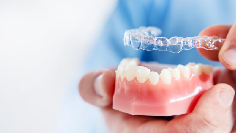 Invisalign for teeth