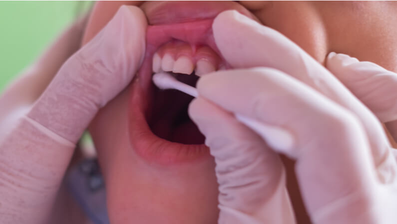 child receiving flouride treatment by dentist