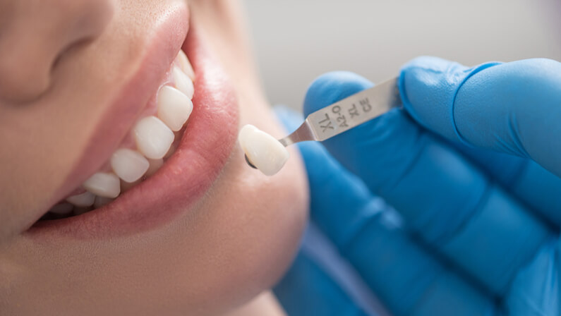 dentist putting dental crown to a patient