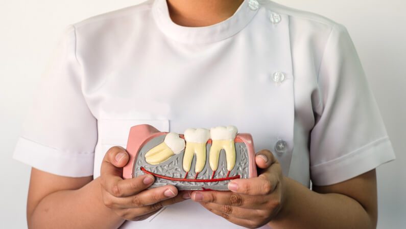 medical personnel holding a impacted wisdom tooth illustration
