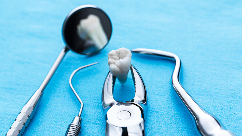 wisdom tooth removal cost