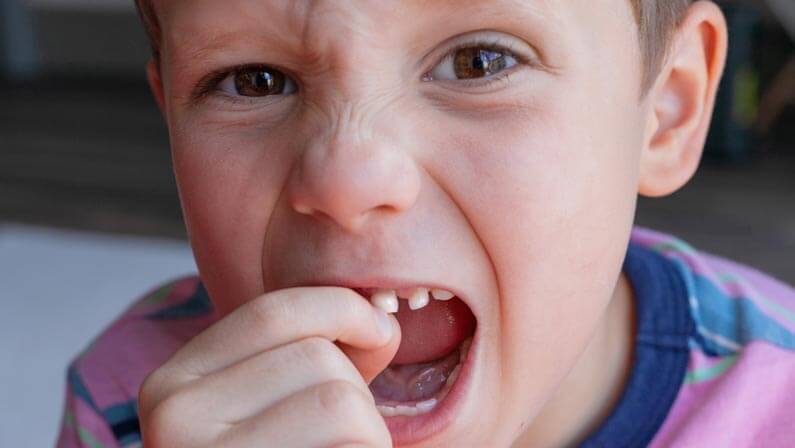 child pulling his own tooth