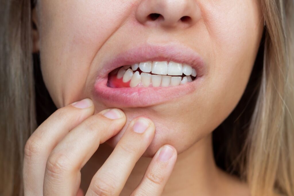 Understanding Gum Disease: Symptoms, Treatment, and Prevention
