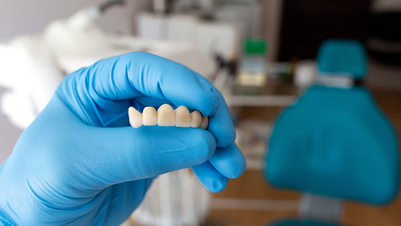 The dentist holds a ceramic, zirconium, bridge-shaped, non-removable dental prosthesis in his hand. Dental bridge.