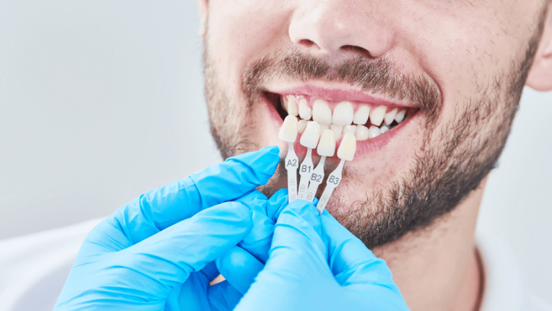 dentistry. matching colour of the tooth enamel with whitening chart