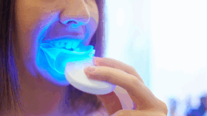 Teeth Whitening
