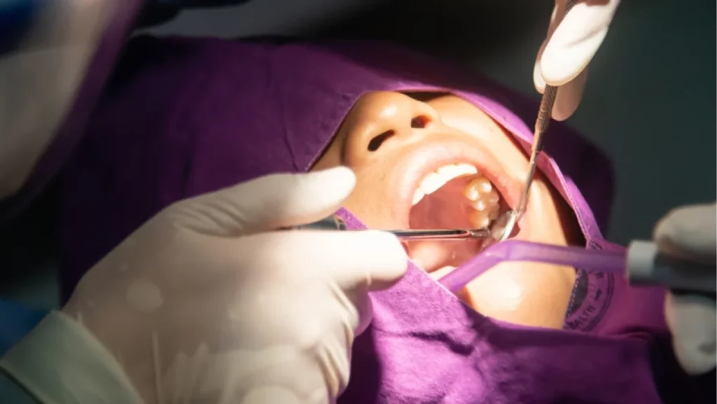 On going wisdom teeth removal