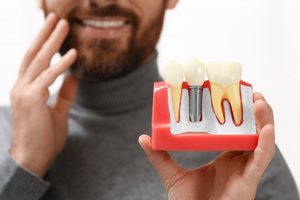 dental implants in Houston