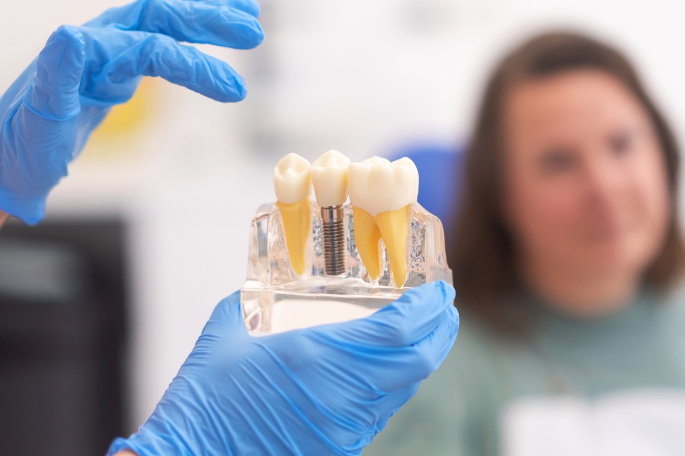 Close-up of dental model with implant. patient of dental clinic on blurred background.